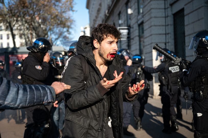 Arthur Naciri frappé en manifestation violences policières Lyon